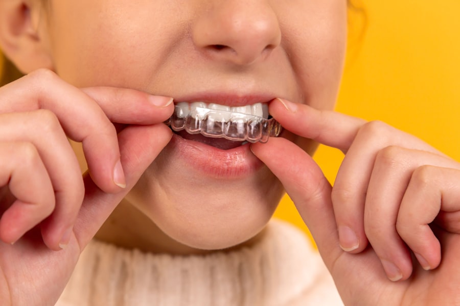 Before — patient smile study